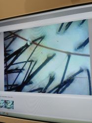 -史云逊养发护发