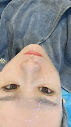 -More摩尔医美の注射线雕光电中心