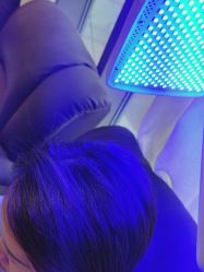 -碧莲盛·不剃发植发