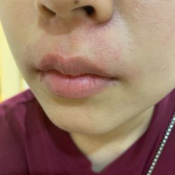 -南宁华美医疗美容医院