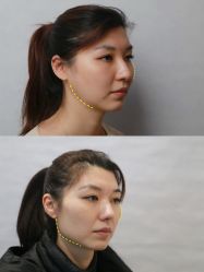 -上海时光整形外科医院
