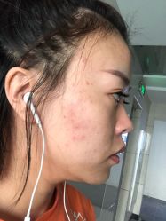 -痘院士专业祛痘皮肤管理