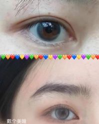 点击看大图 -深圳美莱医疗美容医院