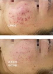 -春田皮肤管理中心品牌旗舰店