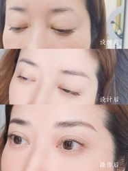 -西施无菌半永久纹绣眉眼影唇轻增发纹发际线
