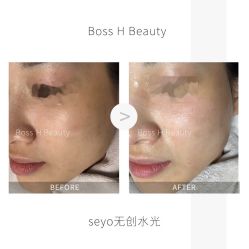 -Boss H Beauty美肌中心