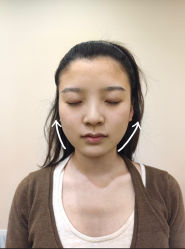 -颜和骨正·明哲式骨相美学整骨