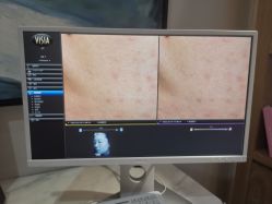 -苑苑vbeauty科技美容SPA