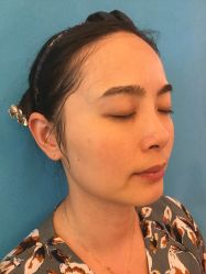 体验前-成都大华医学美容医院