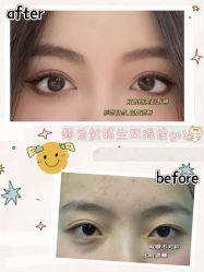 -素美医疗美容·西南眼鼻整形·修复基地