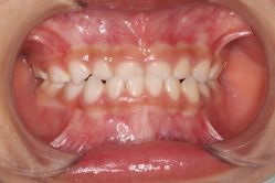 -青苗儿童口腔(长楹天街购物中心)