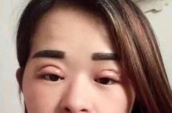 -厦门美莱整形美容医院