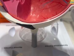 -西安普瑞眼科医院·近视手术·视力防控