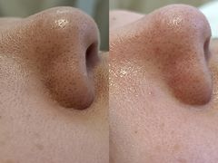 -中粮·祥云小镇