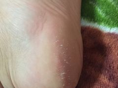 -郑远元专业修脚房(栖山路店)