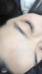 点击看大图 -郡艺医疗美容·微整·眼鼻吸脂