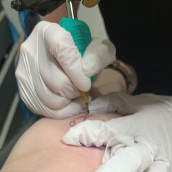 -明星刺青·洗纹身