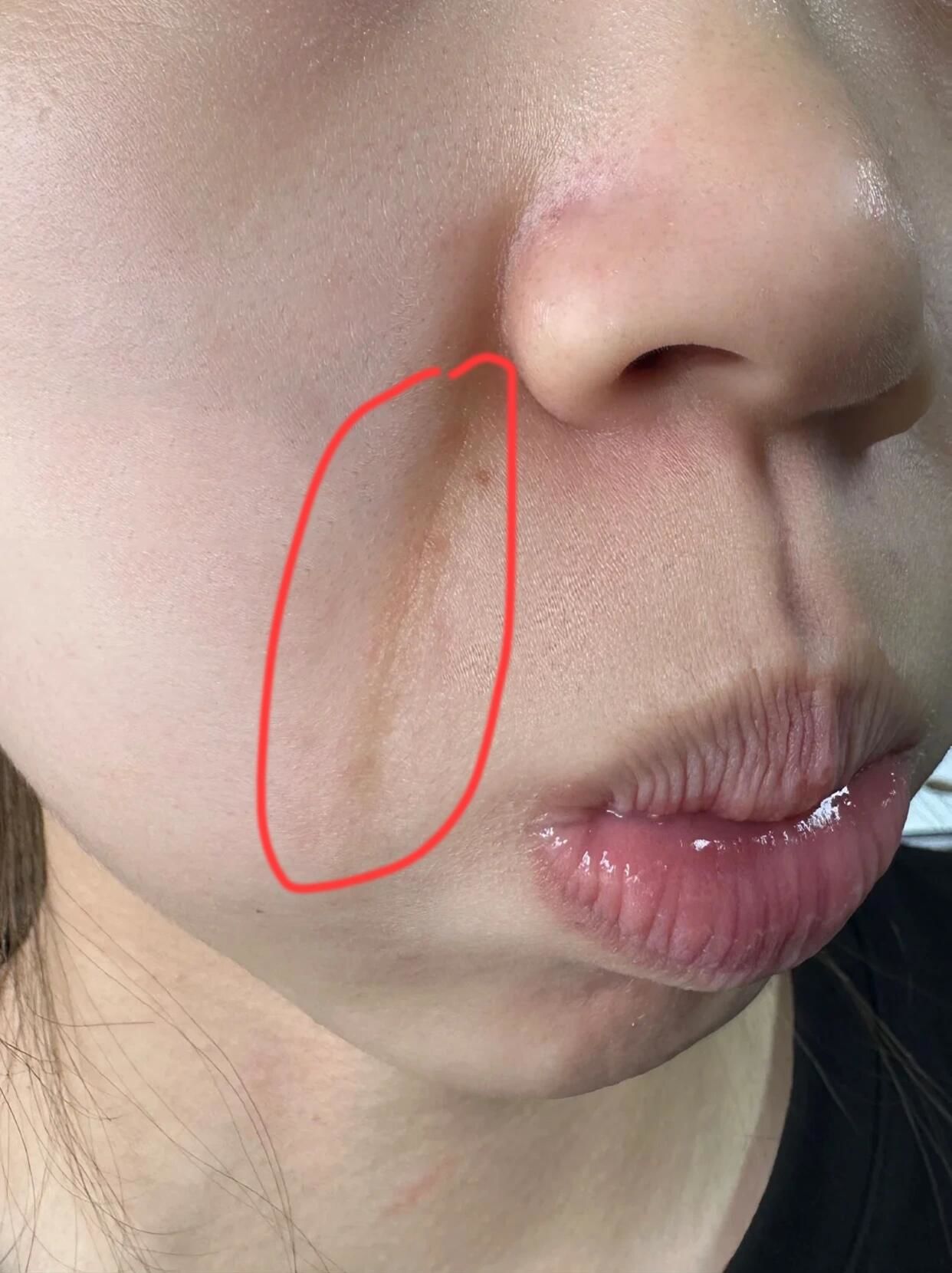 姐妹们!原来法法令纹就这么简单!