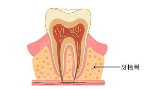 n牙槽骨又被称为牙槽骨嵴,主要位于口内上,下颌骨中围绕牙根部的骨