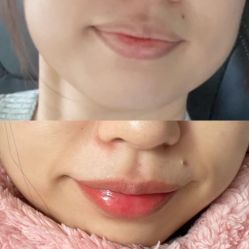 -美愈美肤MEIYU SKIN