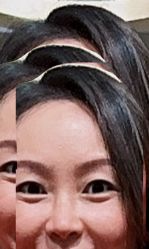点击看大图 -铂诗玥医美