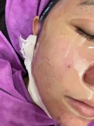 -北京米扬丽格医疗美容·联合丽格鼻整形中心