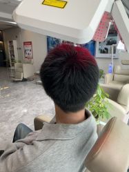 -碧莲盛·不剃发植发
