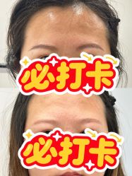 点击看大图 -张小野·专业半永久纹眉