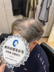 -唐风采假发补发定制