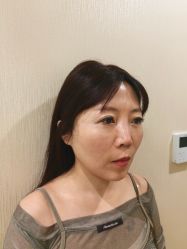 -万州华美紫馨整形美容医院
