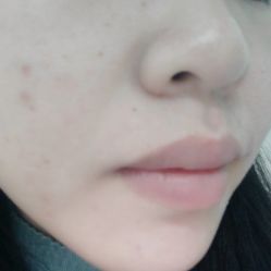 -一美医疗美容