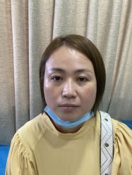 点击看大图 体验前-重庆联合丽格第五医疗美容医院