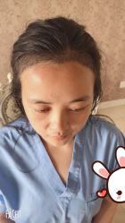 点击看大图 -大麦微针植发丨全国连锁