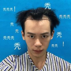 -碧莲盛·不剃发植发