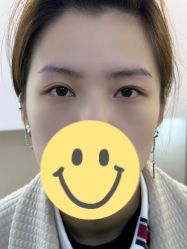 -德绣·机器野生眉发际线·美瞳线半永久