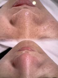 -SKIN79皮肤管理中心