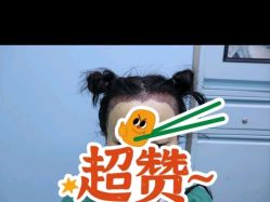 -大麦微针植发全国连锁
