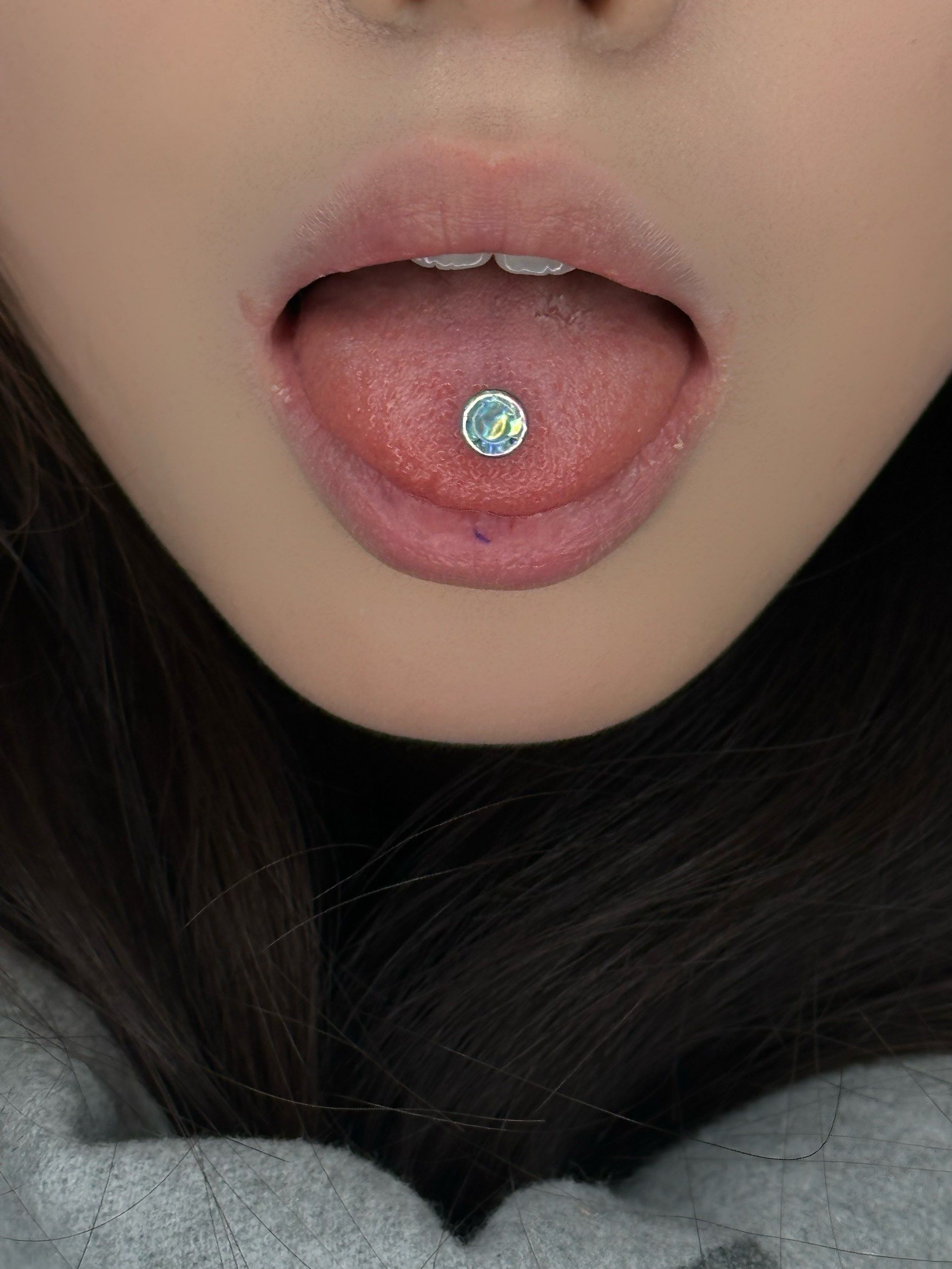 伟德国际打舌钉的危害-即时问医生_权威医患互动平台