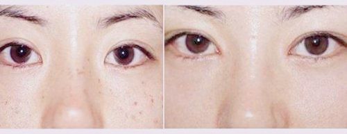 点击看大图 -SKINIST丽铂医疗美容