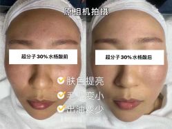 -E.beauty驻颜·痘敏肌调理中心