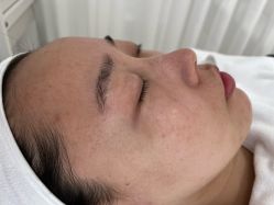 -康美贞·痘肌养护管理中心