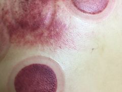 -沈师傅盲人按摩工作室(密三小区店)