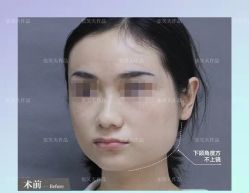 -圣嘉新医疗美容医院