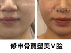 -修申骨雕小颜脊柱骨盆管理产后修复