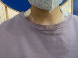 体验后-美莱医学美容医院