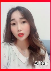 -小忠丽格医美