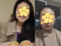 -上海华美医疗美容医院