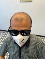 -唐风采假发补发定制