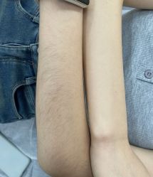 -植蔻妍倍儿专业脱毛·皮肤管理