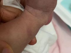 -天津市第三中心医院